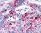 CNR2 / CB2 Antibody (Cytoplasmic Domain)